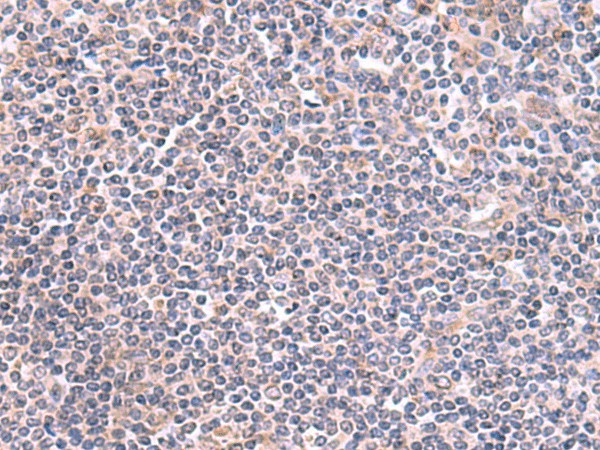 Immunohistochemistry of paraffin-embedded Human tonsil tissue  using GMDS Polyclonal Antibody at dilution of 1:70(?200)