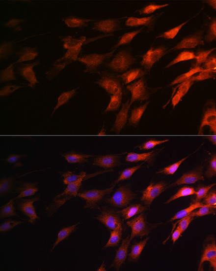 Immunofluorescence analysis of C6 cells using Neurofilament H Polyclonal Antibody at dilution of 1:100 (40x lens). Blue: DAPI for nuclear staining.