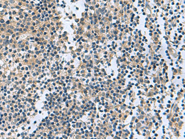 Immunohistochemistry of paraffin-embedded Human tonsil tissue  using RGS2 Polyclonal Antibody at dilution of 1:95(?200)