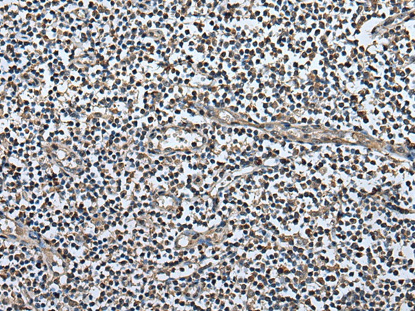 Immunohistochemistry of paraffin-embedded Human tonsil tissue  using UTP3 Polyclonal Antibody at dilution of 1:50(?200)