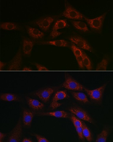 Immunofluorescence analysis of NIH/3T3 cells using ABCA1 Polyclonal Antibody at dilution of 1:100 (40x lens). Blue: DAPI for nuclear staining.