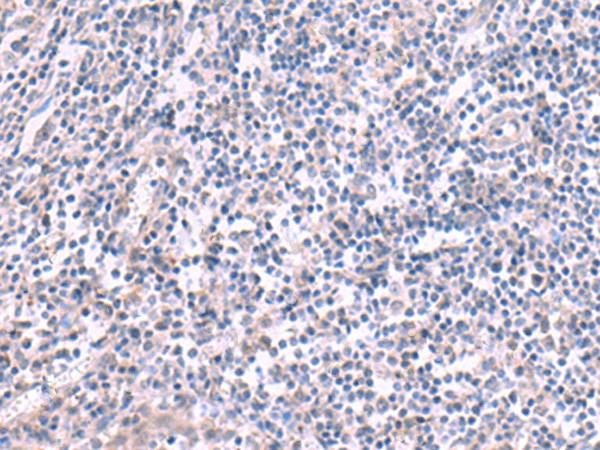 Immunohistochemistry of paraffin-embedded Human tonsil tissue  using KCNK10 Polyclonal Antibody at dilution of 1:45(?200)