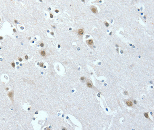 Immunohistochemistry of paraffin-embedded Human brain  tissue using ACLY Polyclonal Antibody at dilution 1:40