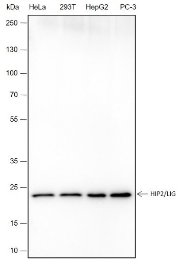 Recombinant HIP2/LIG Monoclonal Antibody-searchlist-1