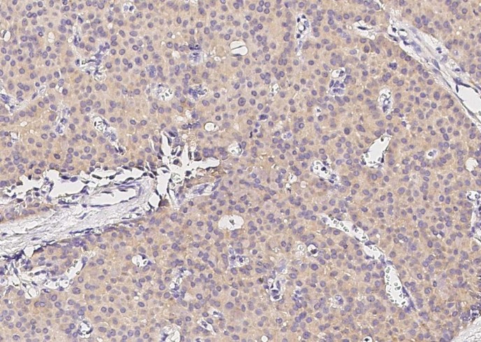 Recombinant GDF-3 Monoclonal Antibody - small - 2