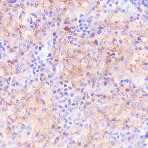 Recombinant CD40 Monoclonal Antibody - 2