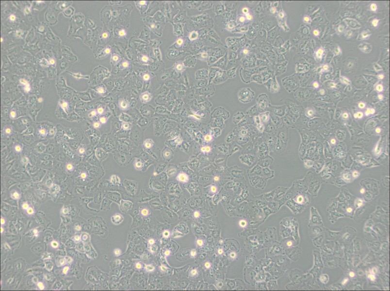 Caov-3 Cell Complete Medium - 2