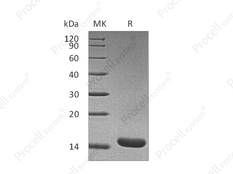 TNF-&alpha;/TNFA/TNFSF2, Rat, Recombinant