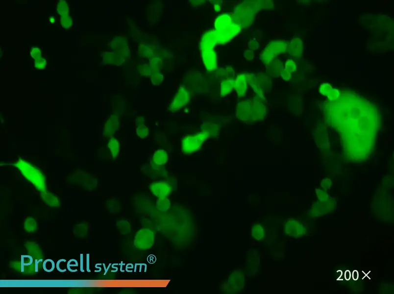 4T1-GFP - 5