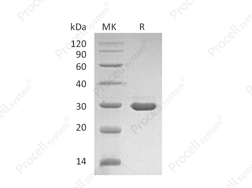 &beta;-NGF/NGF/NGFB (Glu19-Ala241), Human, Recombinant