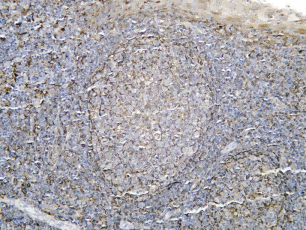 Recombinant MARCKS Monoclonal Antibody - 1