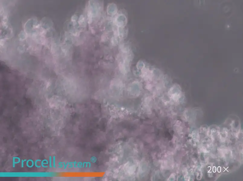 NCI-H660 Cell Complete Medium - 6