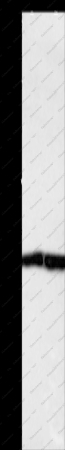MKP-3 Polyclonal Antibody - 1