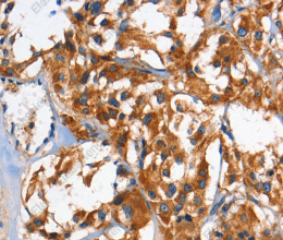 HK2 Polyclonal Antibody - 2
