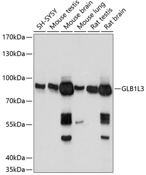 Western blot analysis of extracts of various cell lines using GLB1L3 Polyclonal Antibody at 1:1000 dilution.