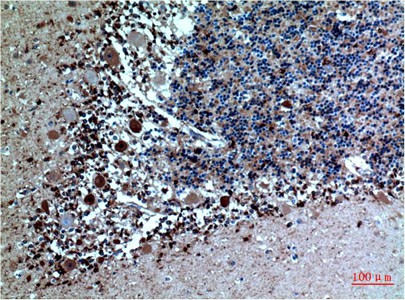 Immunohistochemistry of paraffin-embedded Human brain tissue using CST3 Monoclonal Antibody at dilution of 1:200.