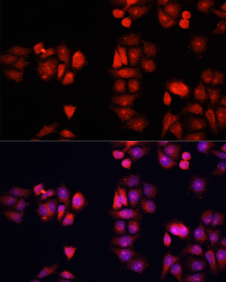 Immunofluorescence analysis of HeLa cells using BMP1 Polyclonal Antibody at dilution of  1:100. Blue: DAPI for nuclear staining.