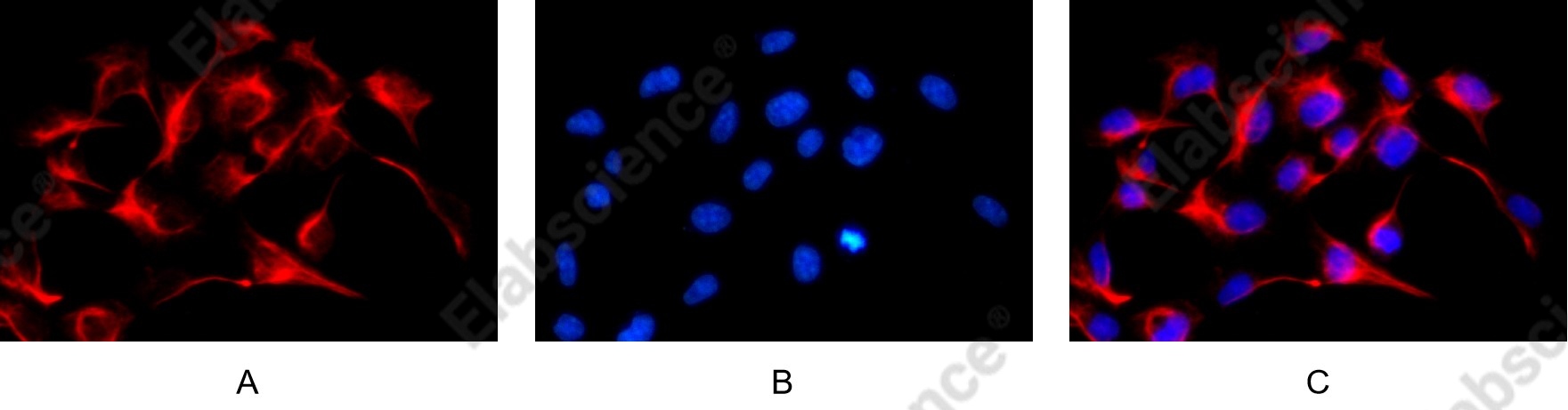 Recombinant Vimentin Monoclonal Antibody - 9