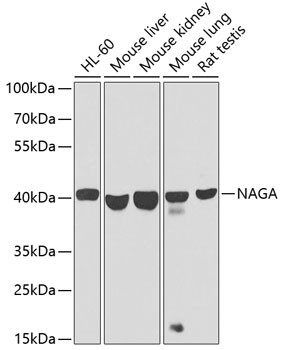 Western blot analysis of extracts of various cell lines using NAGA Polyclonal Antibody at dilution of 1:1000.