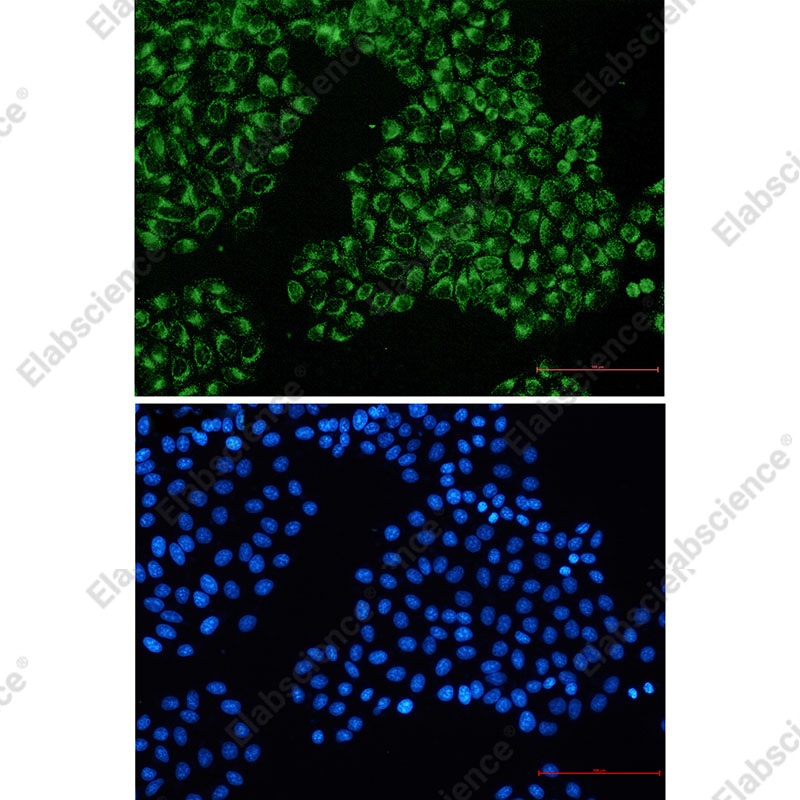 Recombinant FGFR3 Monoclonal Antibody - 2