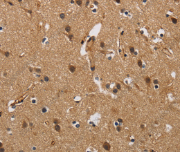 FABP2 Polyclonal Antibody - 3