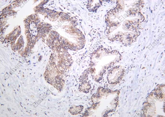 Recombinant YB-1 Monoclonal Antibody - 2