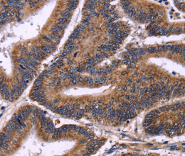 AMIGO2 Polyclonal Antibody - 2
