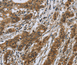 IL5RA Polyclonal Antibody - 3