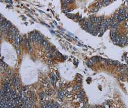 NDUFA13 Polyclonal Antibody - 3