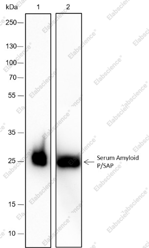 Recombinant Serum Amyloid P/SAP Monoclonal Antibody - 1