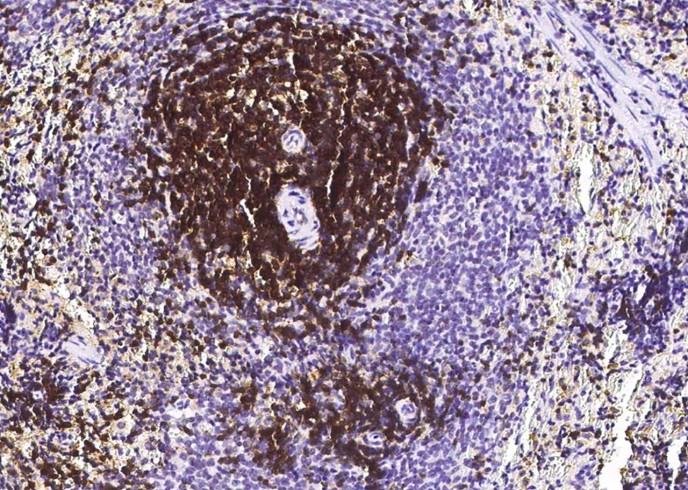CD6/Cluster of Differentiation 6 Monoclonal Antibody - small - 2