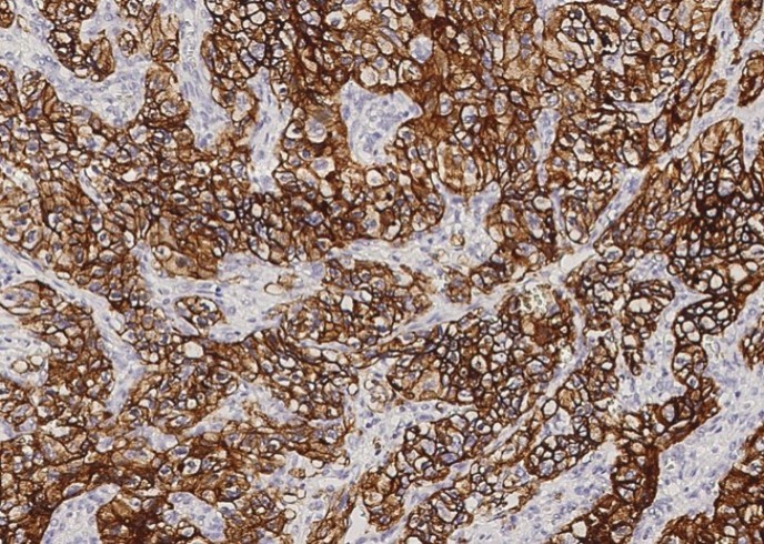 Carbonic Anhydrase IX/CA9 Monoclonal Antibody - small - 2