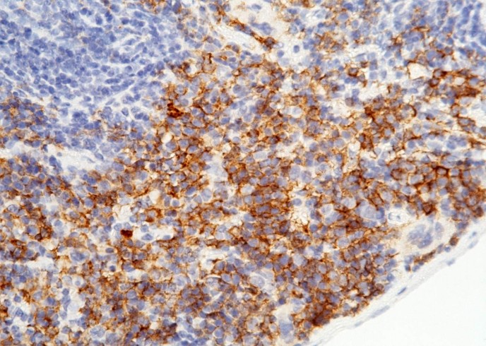 Recombinant CD64/FCGR1 Monoclonal Antibody-searchlist-1