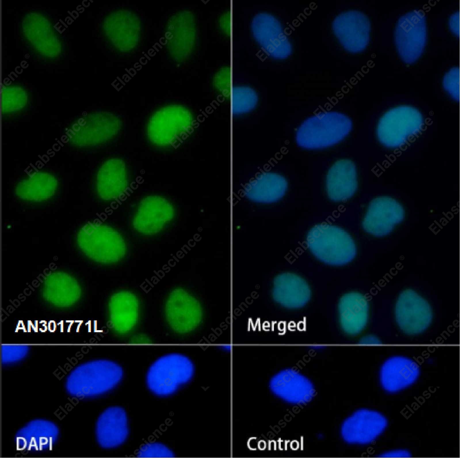 Recombinant CHD3 Monoclonal Antibody - 2