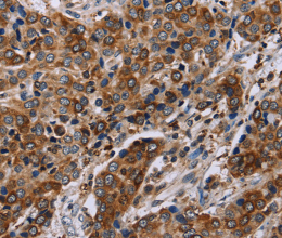 FAF1 Polyclonal Antibody - 2
