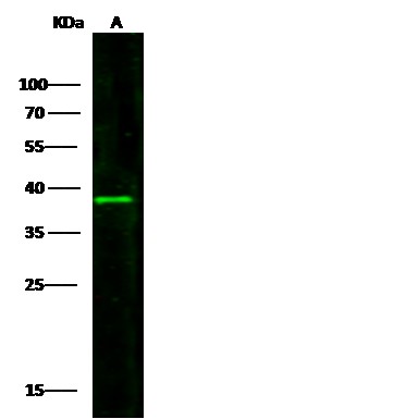 Recombinant IL3RA/CD123 Monoclonal Antibody - small - 2