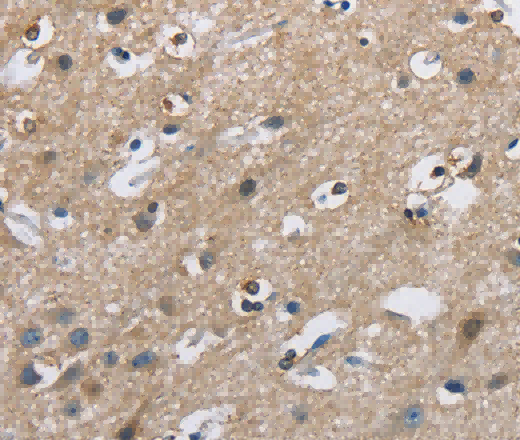 CAB39L Polyclonal Antibody - 3