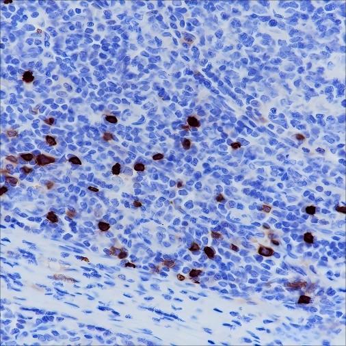 Recombinant CD1a Monoclonal Antibody - small - 4