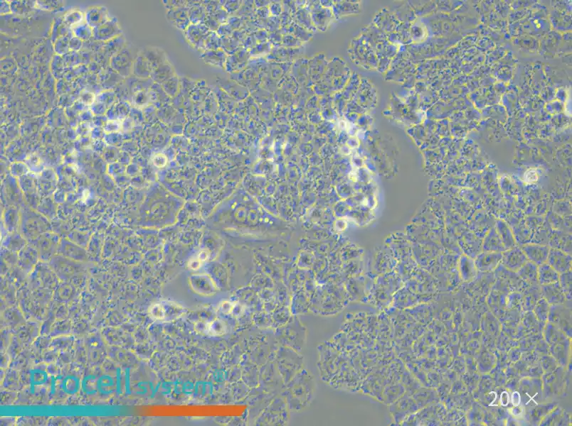 NCI-H460 [H460] Cell Complete Medium - small - 5