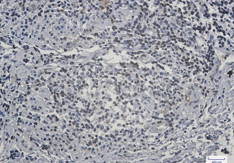 Recombinant Lamin B Receptor Monoclonal Antibody - 2