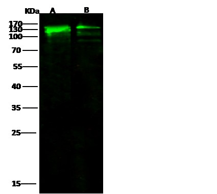 Recombinant E-Cadherin/CDH1/E-cad/CD324 Monoclonal Antibody - small - 2