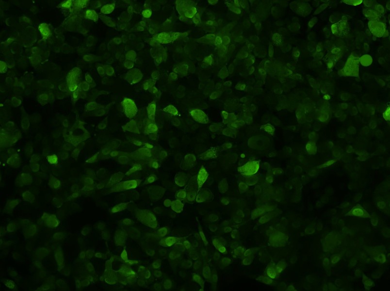PC-3-GFP Cell Complete Medium - 3