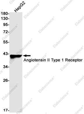 Recombinant Angiotensin II Type 1 Receptor Monoclonal Antibody - 1