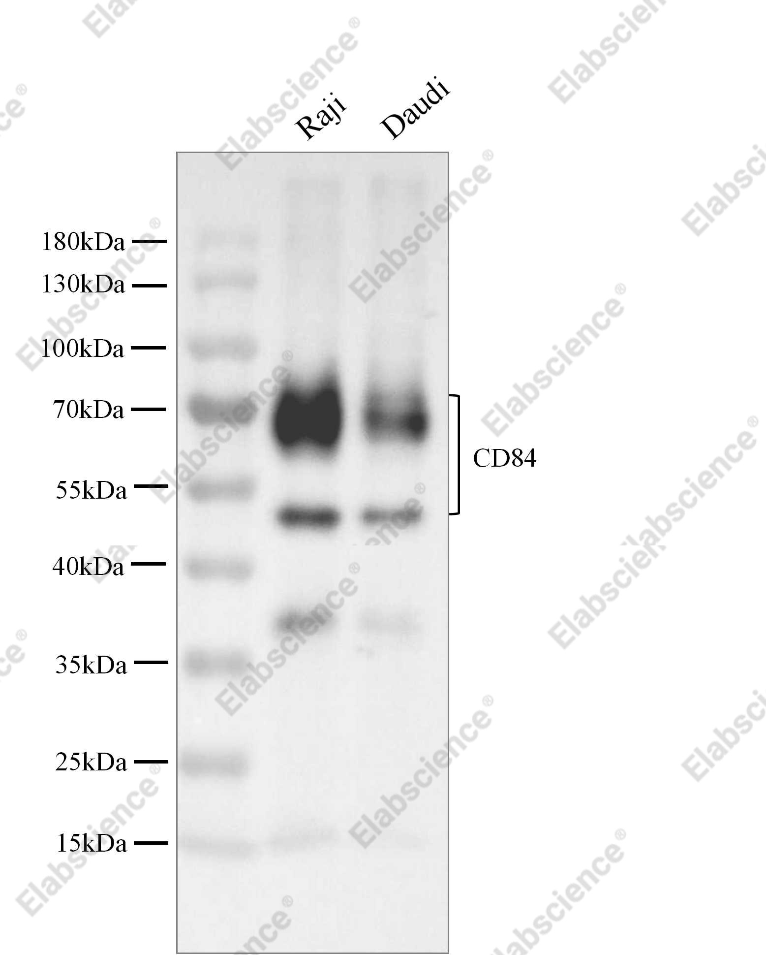 Recombinant CD84/SLAMF5 Monoclonal Antibody - 2