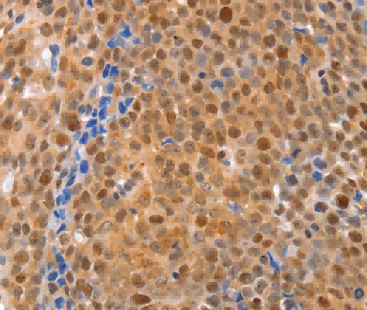 MKP-2 Polyclonal Antibody - 2