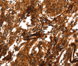 ACTA2 Polyclonal Antibody - 3