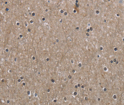 PPAT Polyclonal Antibody - 3