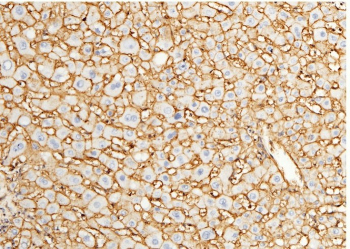Recombinant CD147/EMMPRIN/Basigin Monoclonal Antibody - small - 7