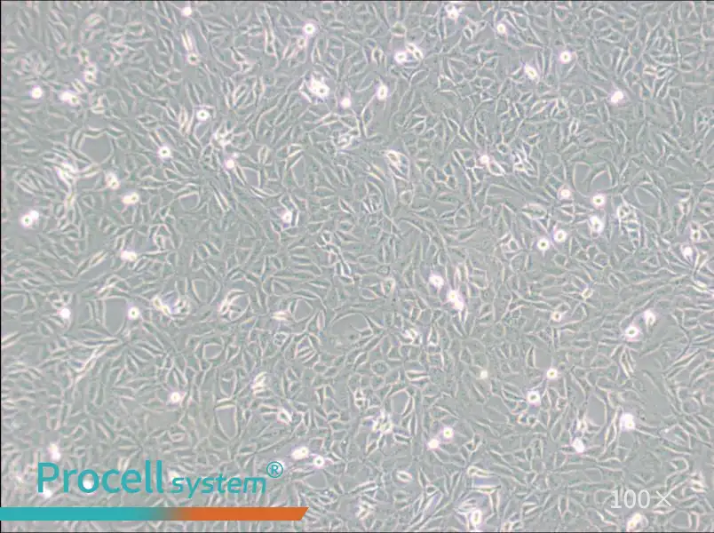 9L/lacZ Cell Complete Medium - 1