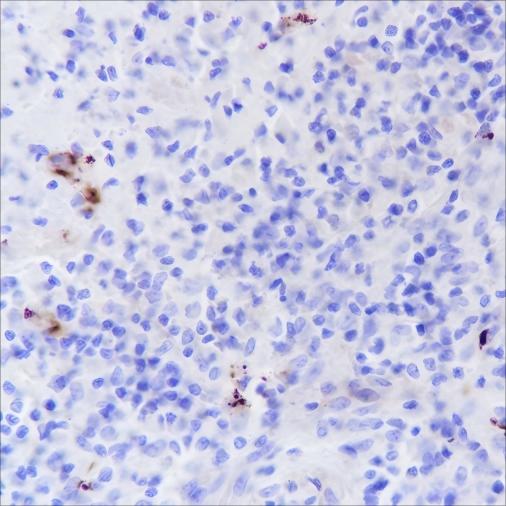 Recombinant CD42b Monoclonal Antibody - 2